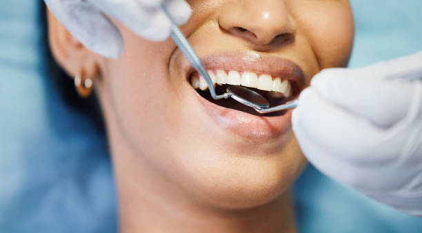 Best Emergency Dental Care for Abscessed Tooth in London, OH