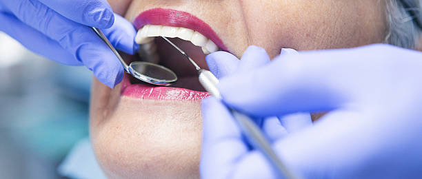 Best Mobile Emergency Dentist in London, OH